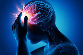 What do migraines feel like?